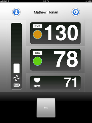 Illustration for article titled Withings Blood Pressure Monitor Review: A Great Squeeze